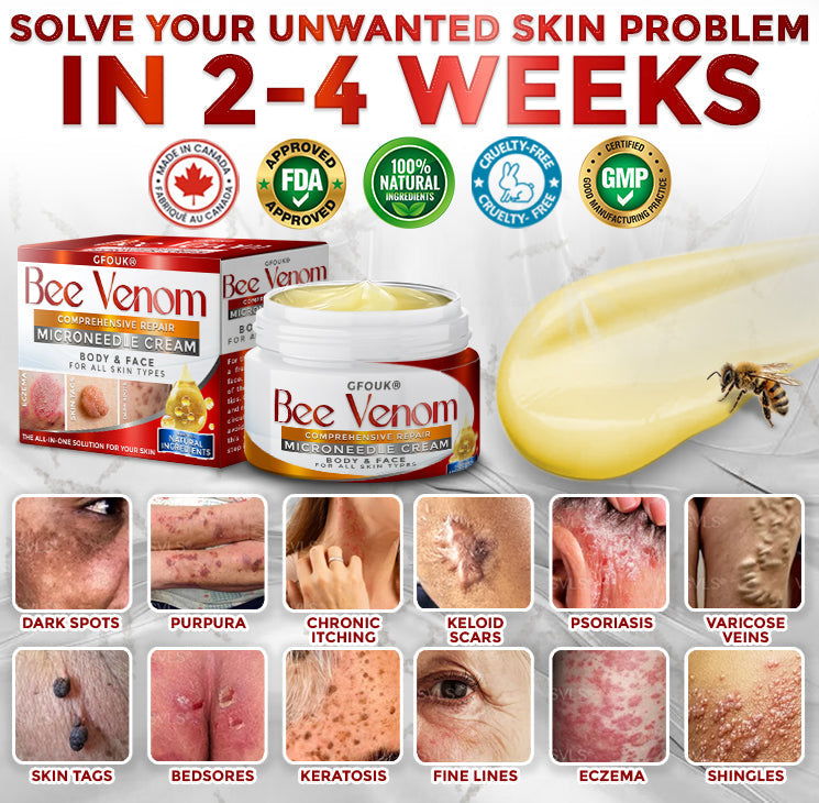 GFOUK® Bee Venom Comprehensive Repair Microneedle Cream