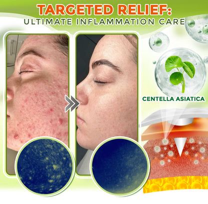 GFOUK® Comprehensive Microneedle Patch 🇨🇦