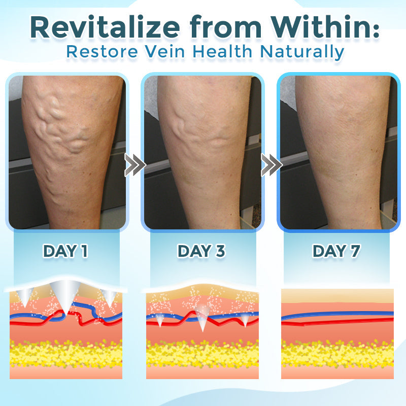 GFOUK® VenaRestore MicroNeedle Vein Repair Patch 🇨🇦