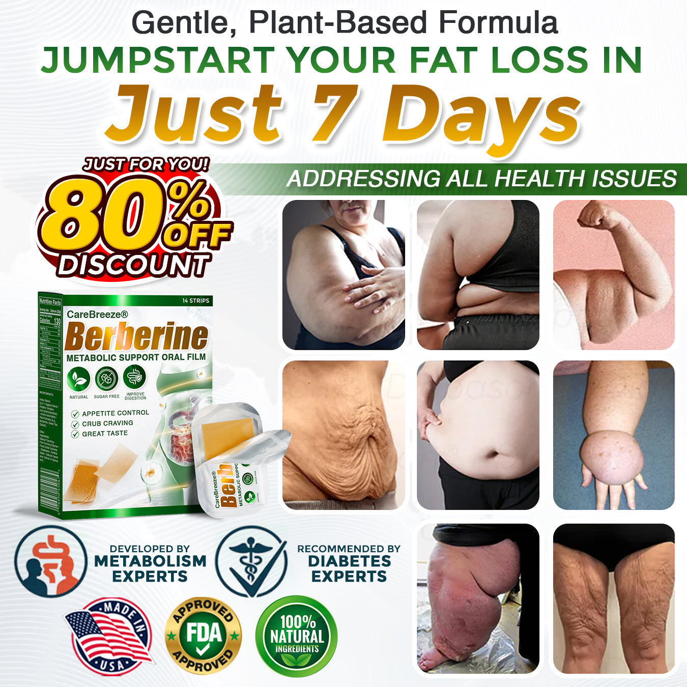 𝗖𝗮𝗿𝗲𝗕𝗿𝗲𝗲𝘇𝗲® Berberine 𝑺𝒍𝒊𝒎 𝑭𝒂𝒔𝒕 7 𝑫𝒂𝒚𝒔 Metabolic Support Oral Film (✅ 𝐓𝐚𝐫𝐠𝐞𝐭𝐬 𝐰𝐞𝐢𝐠𝐡𝐭, 𝐡𝐞𝐚𝐫𝐭, 𝐛𝐥𝐨𝐨𝐝 𝐬𝐮𝐠𝐚𝐫, 𝐬𝐥𝐞𝐞𝐩, 𝐠𝐮𝐭 & 𝐣𝐨𝐢𝐧𝐭 𝐡𝐞𝐚𝐥𝐭𝐡)