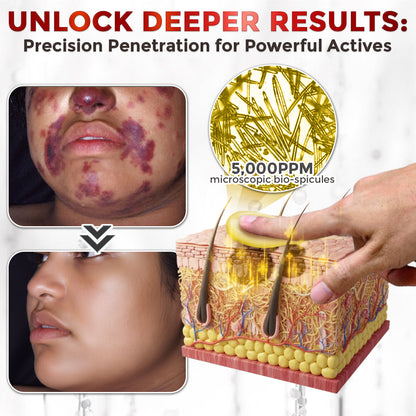 GFOUK® Bee Venom Comprehensive Repair Microneedle Cream