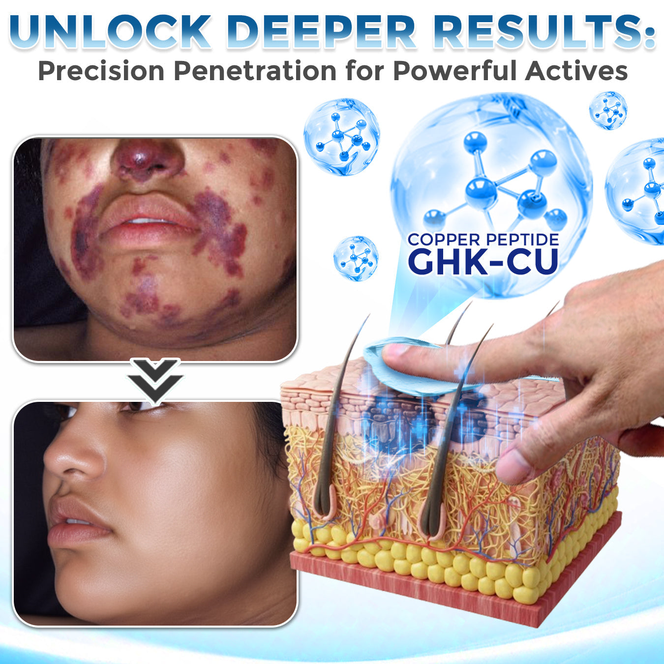GFOUK® GHK-Cu Copper Peptide Comprehensive Cream